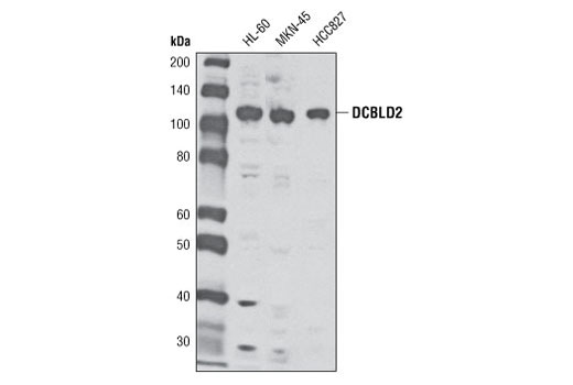 Western Blotting Image 1: DCBLD2 Antibody
