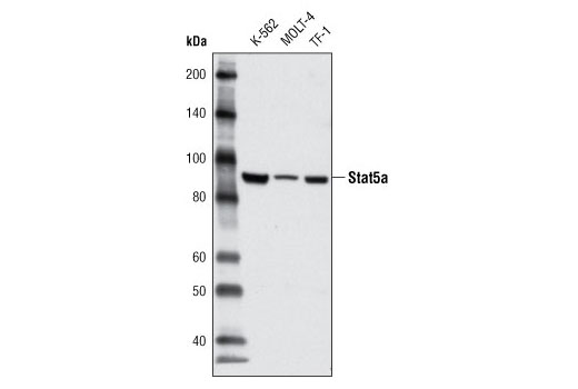 Western Blotting Image 1: Stat5a (4H1) Mouse mAb