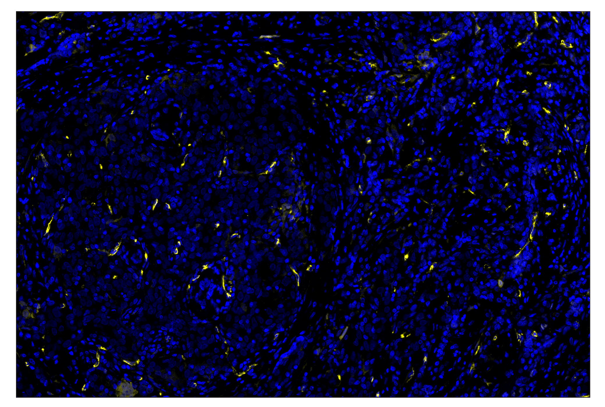 Immunohistochemistry Image 1: CD34 (ICO115) & CO-0227-488 SignalStar<sup>®</sup> Oligo-Antibody Pair