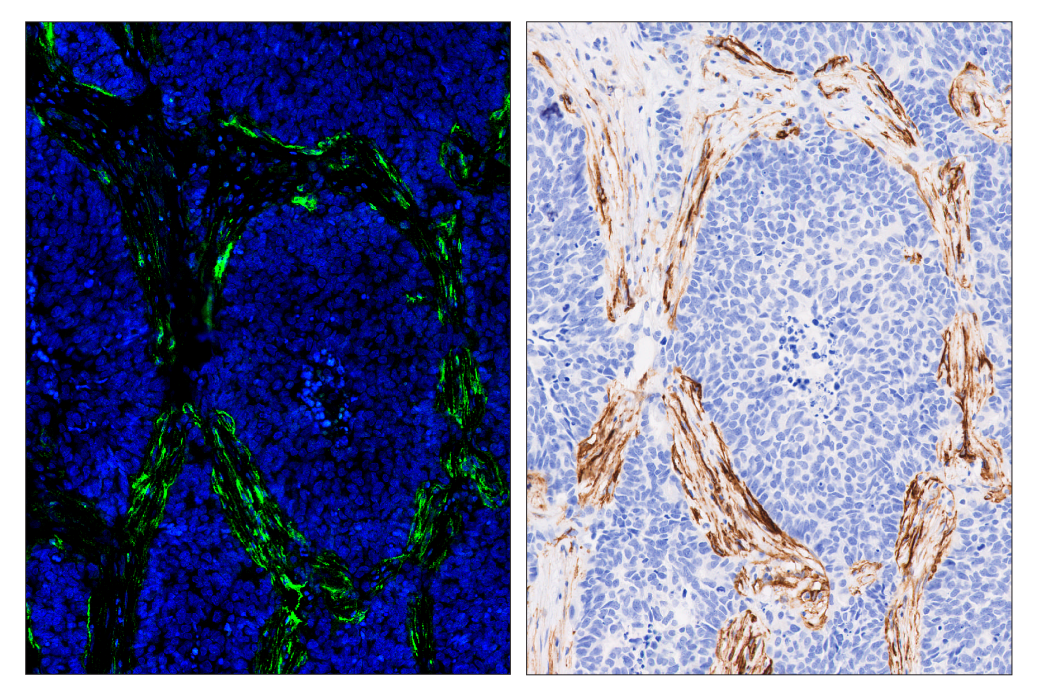 Immunohistochemistry Image 2: CD34 (ICO115) & CO-0227-488 SignalStar<sup>®</sup> Oligo-Antibody Pair