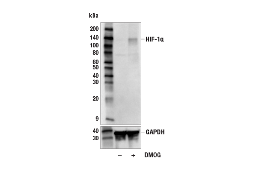  Image 33: Hypoxia Activation IHC Antibody Sampler Kit