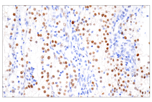 Immunohistochemistry Image 1: HIF-1α (E1V6A) Rabbit mAb