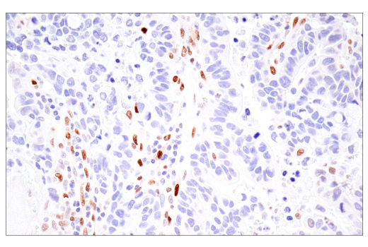 Immunohistochemistry Image 3: HIF-1α (E1V6A) Rabbit mAb