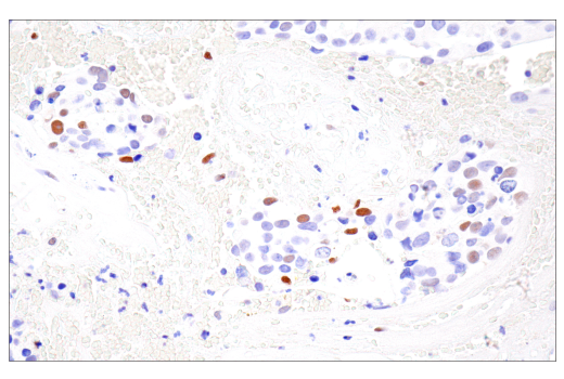 Immunohistochemistry Image 5: HIF-1α (E1V6A) Rabbit mAb