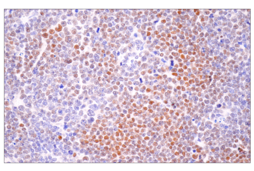 Immunohistochemistry Image 7: HIF-1α (E1V6A) Rabbit mAb