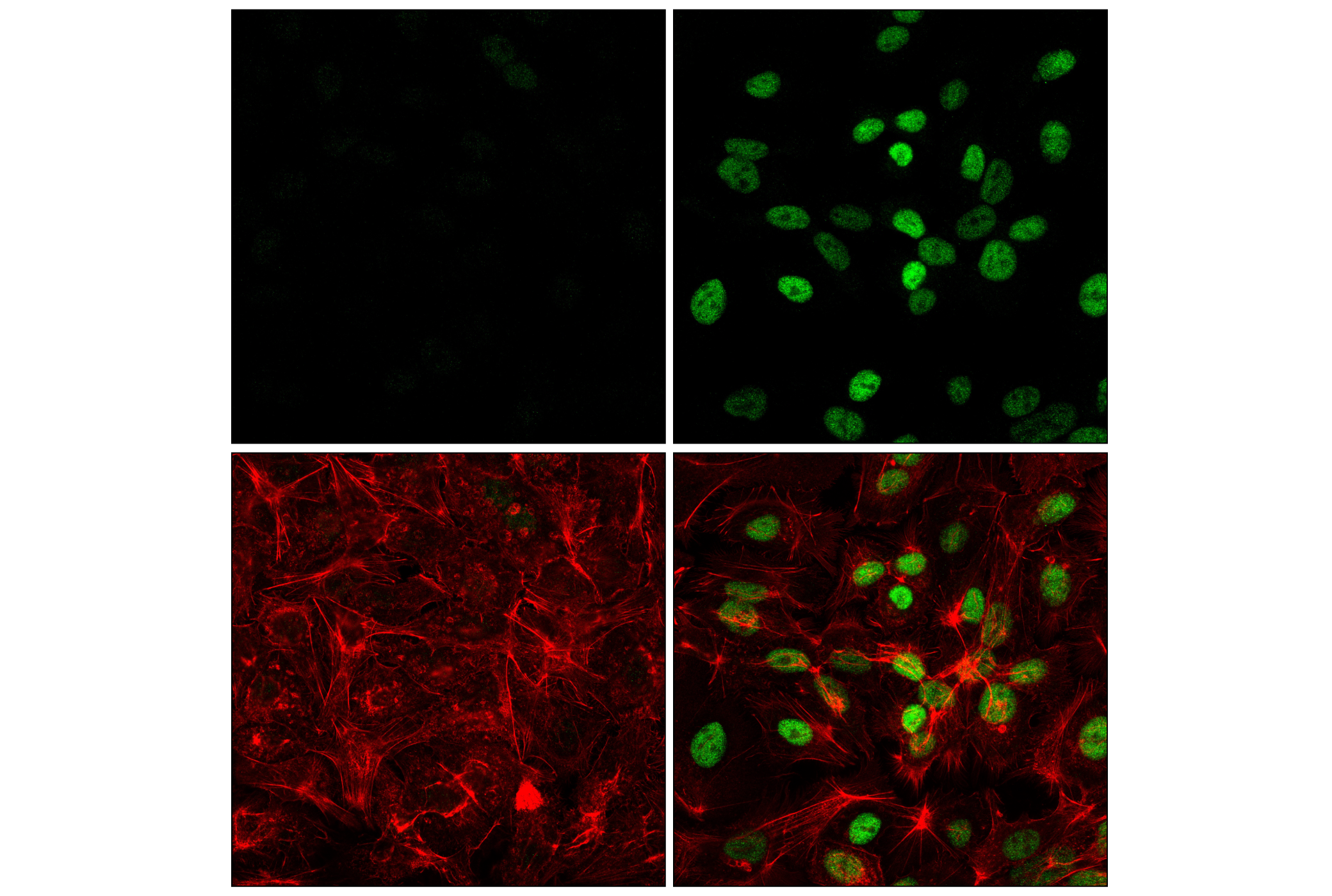 Immunofluorescence Image 1: HIF-1α (E1V6A) Rabbit mAb