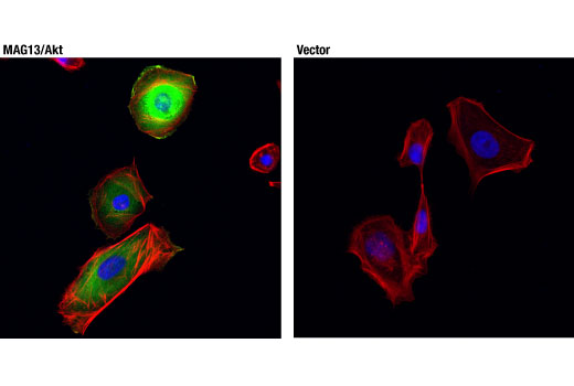 Immunofluorescence Image 1: MAGI3-Akt3 Fusion Protein (D4D3P) Rabbit mAb