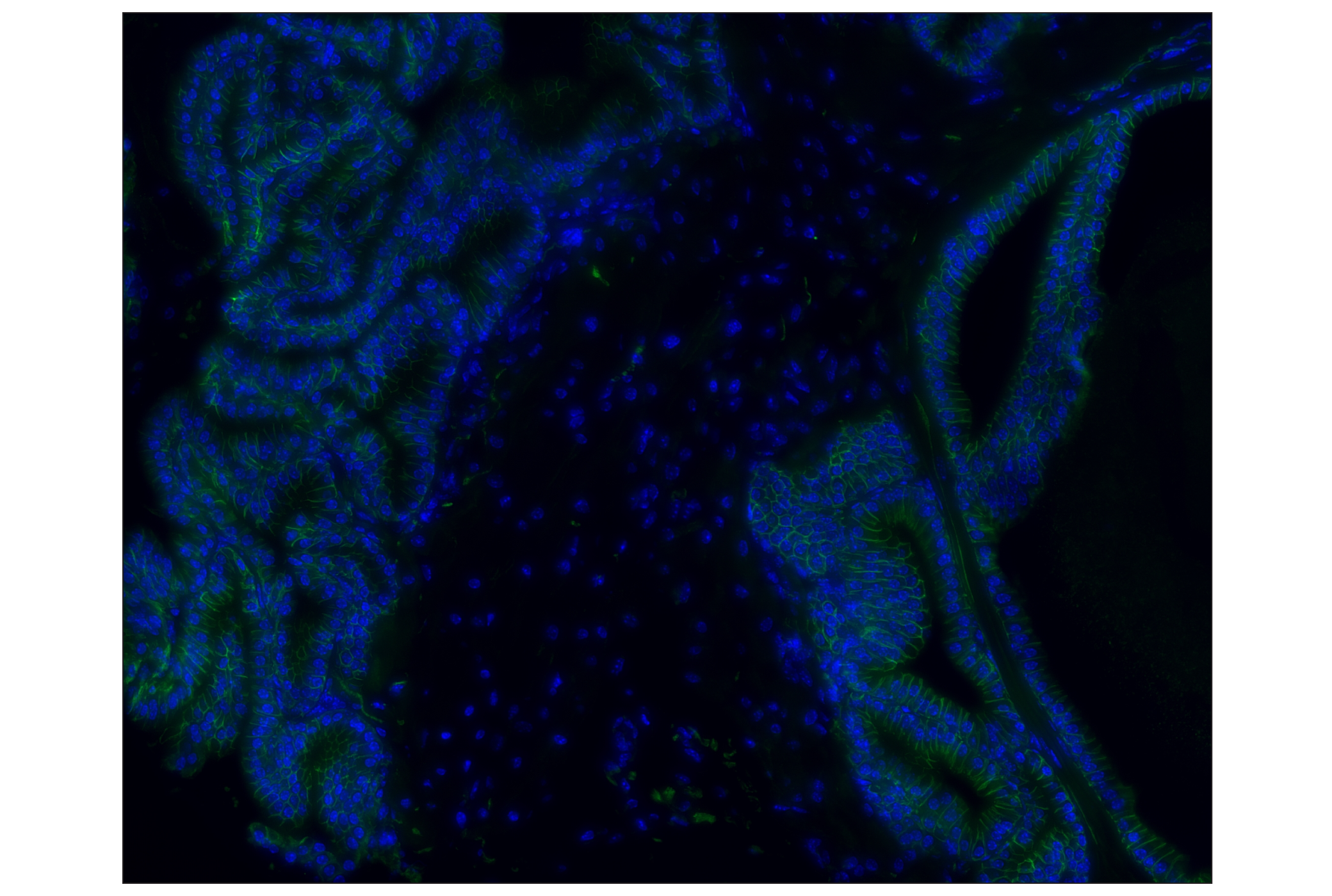 Immunohistochemistry Image 3: NCAM1 (CD56) (E7X9M) XP® Rabbit mAb (Alexa Fluor® 488 Conjugate)