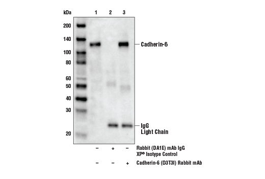 Immunoprecipitation Image 1: Cadherin-6 (D3T3I) Rabbit mAb