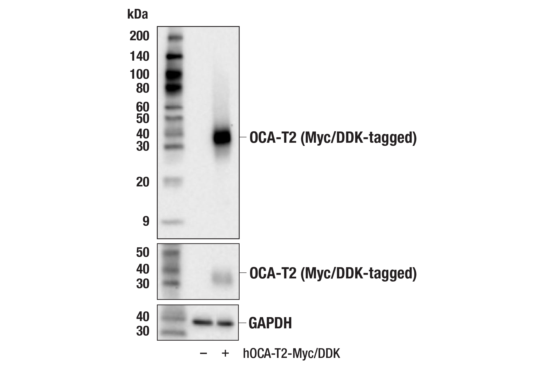 Western Blotting Image 2: OCA-T2 (F5A7Z) Rabbit mAb
