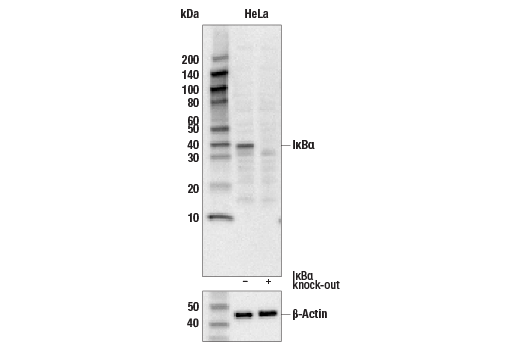  Image 10: NF-κB Pathway Antibody Sampler Kit II