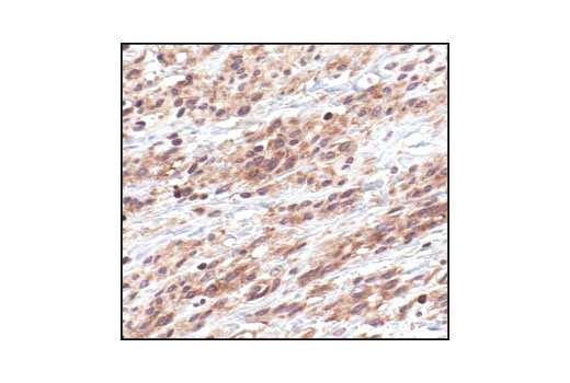 Immunohistochemistry Image 1: IκBα (L35A5) Mouse mAb (Amino-terminal Antigen)