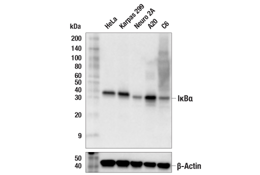 Western Blotting Image 1: IκBα (L35A5) Mouse mAb (Amino-terminal Antigen)
