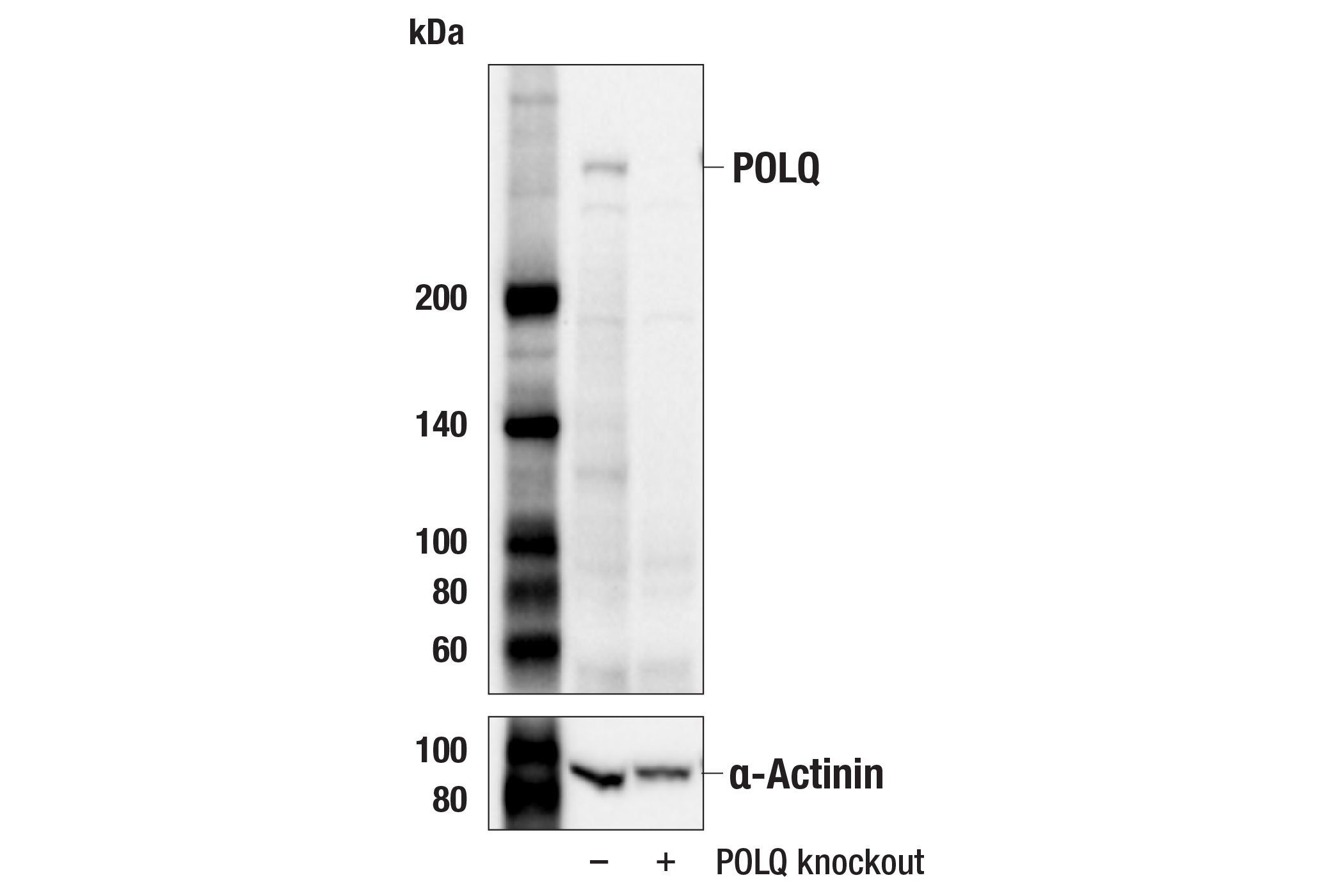 Western Blotting Image 1: DNA Polymerase θ (POLQ) (153-5-1) Mouse mAb
