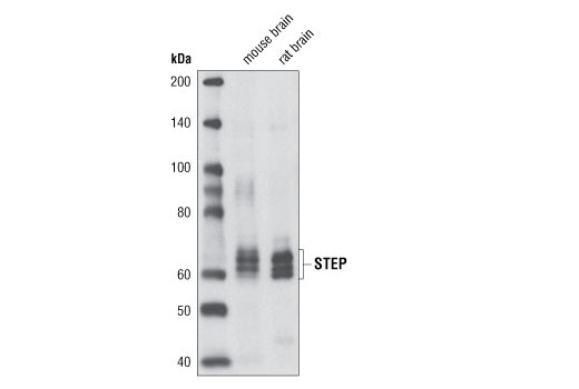 Western Blotting Image 1: STEP Antibody
