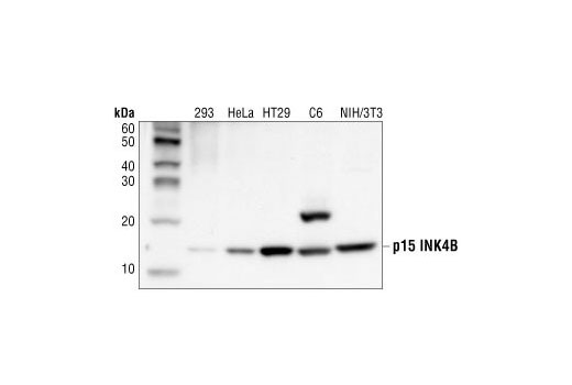  Image 8: Cyclin Dependent Kinase Inhibitor Antibody Sampler Kit