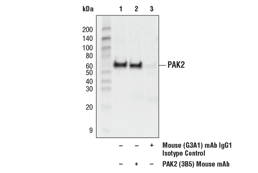 Immunoprecipitation Image 1: PAK2 (3B5) Mouse mAb