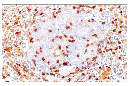Immunohistochemistry Image 10: CD4 (EP204) Rabbit mAb