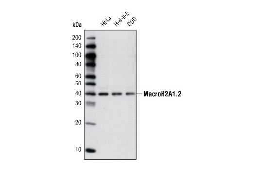 Western Blotting Image 1: MacroH2A1.2 Antibody
