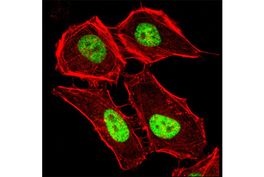 Immunofluorescence Image 1: MacroH2A1.2 Antibody