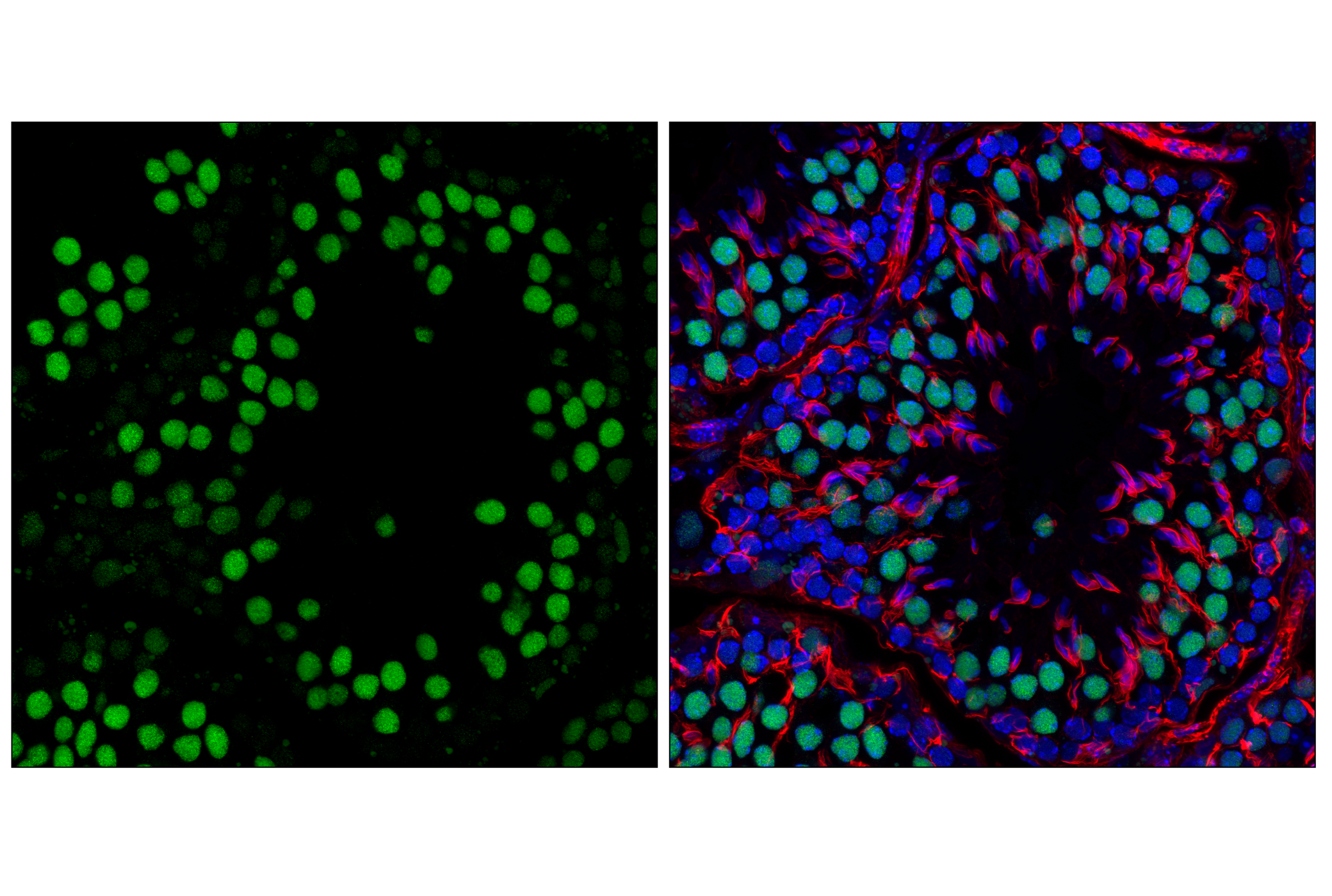 Immunofluorescence Image 1: Anillin (F6M2V) Rabbit mAb
