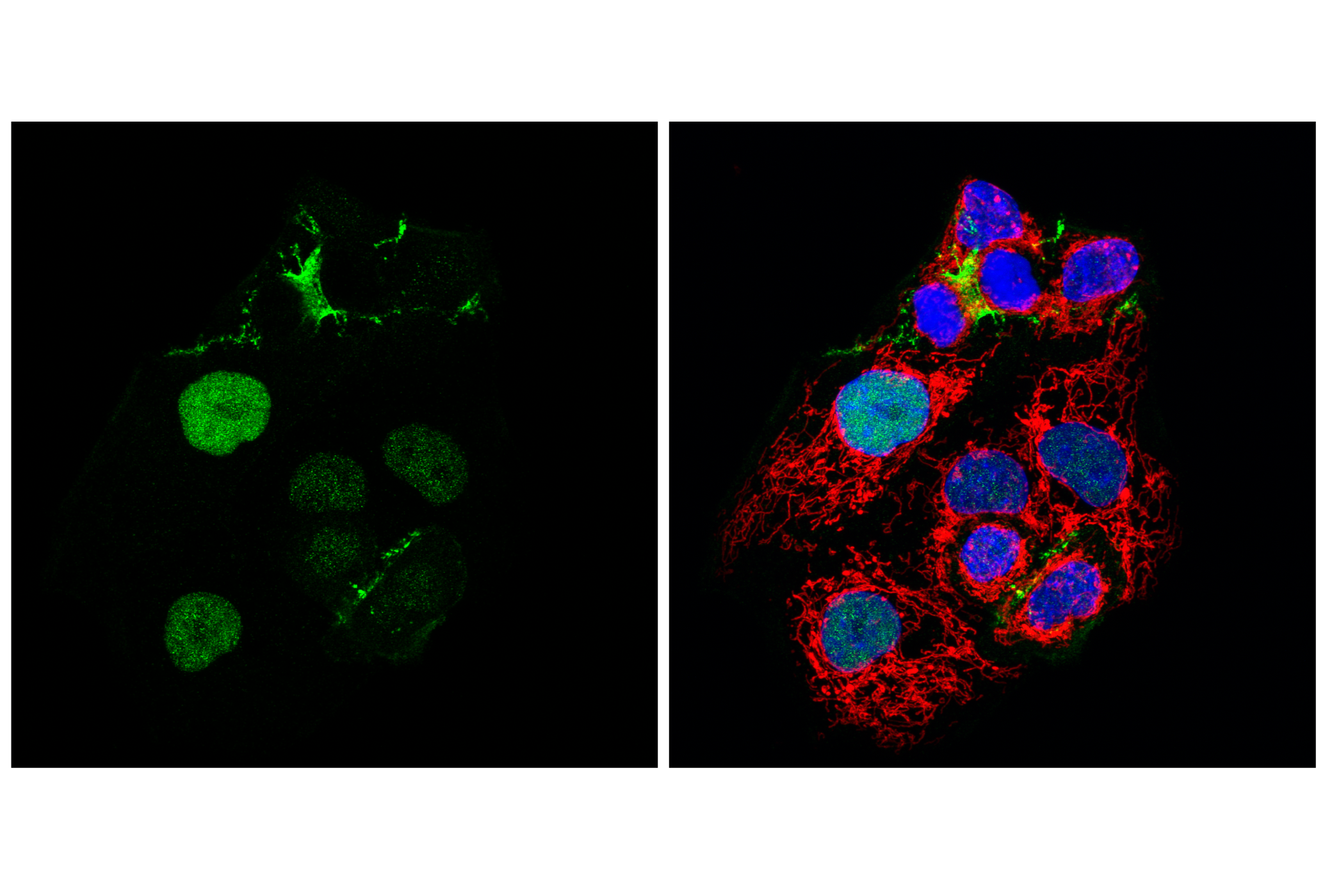 Immunofluorescence Image 2: Anillin (F6M2V) Rabbit mAb