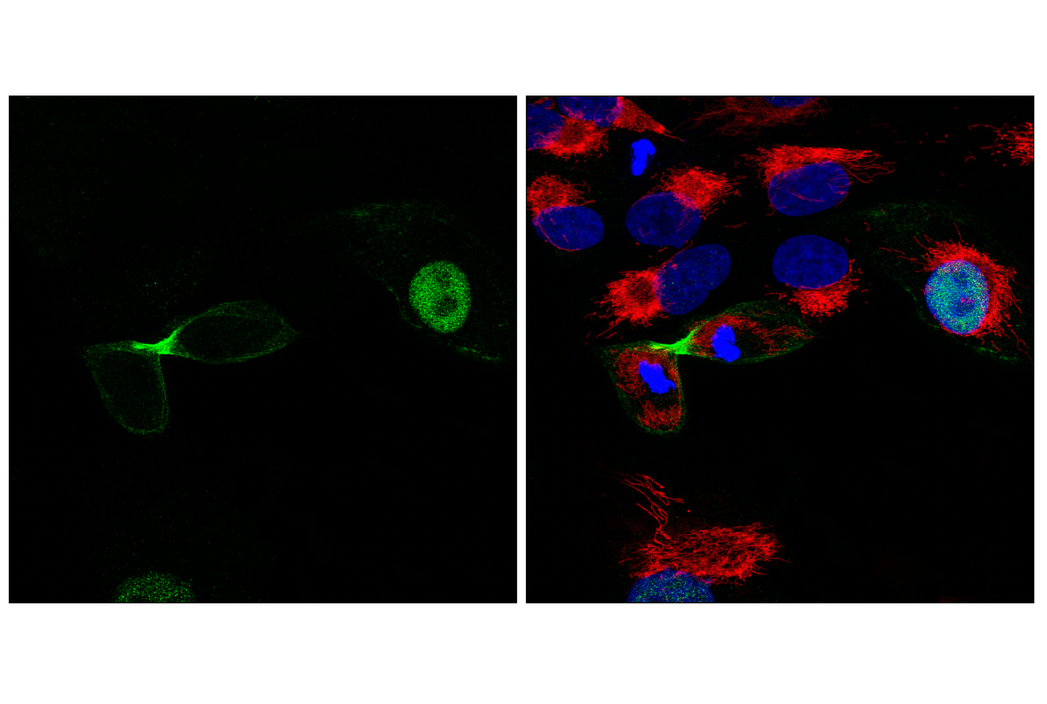 Immunofluorescence Image 3: Anillin (F6M2V) Rabbit mAb
