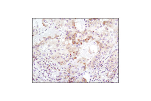 Immunohistochemistry Image 1: TRAIL (C92B9) Rabbit mAb (BSA and Azide Free)