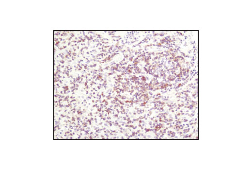 Immunohistochemistry Image 2: TRAIL (C92B9) Rabbit mAb (BSA and Azide Free)