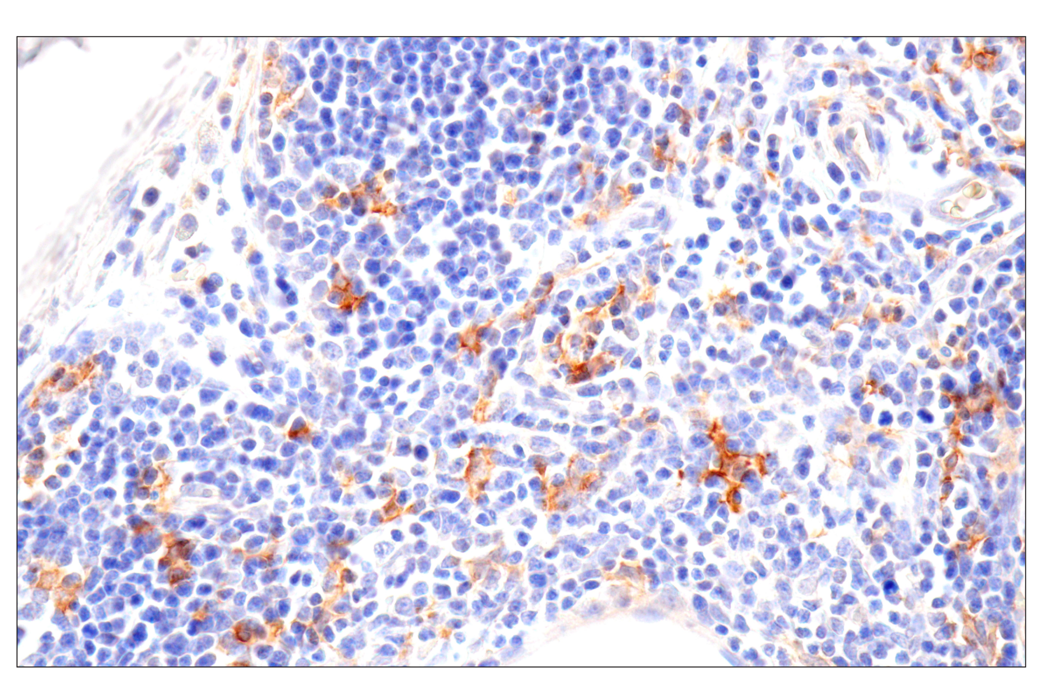 Immunohistochemistry Image 4: SLC40A1/Ferroportin-1 (F9U5S) Rabbit mAb