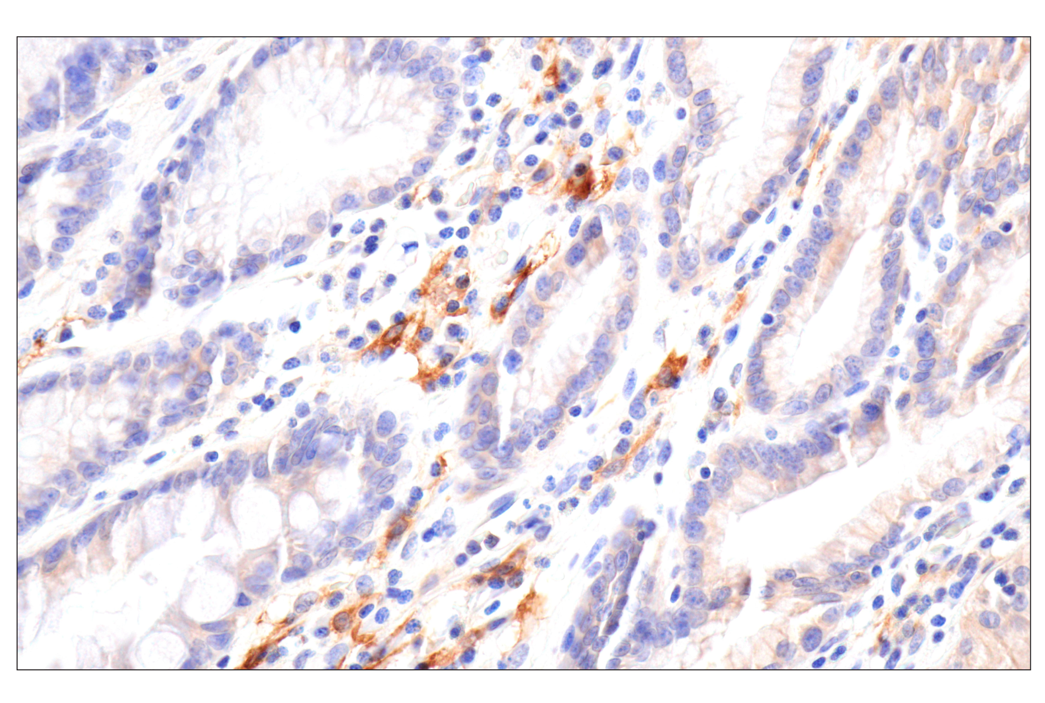 Immunohistochemistry Image 2: SLC40A1/Ferroportin-1 (F9U5S) Rabbit mAb