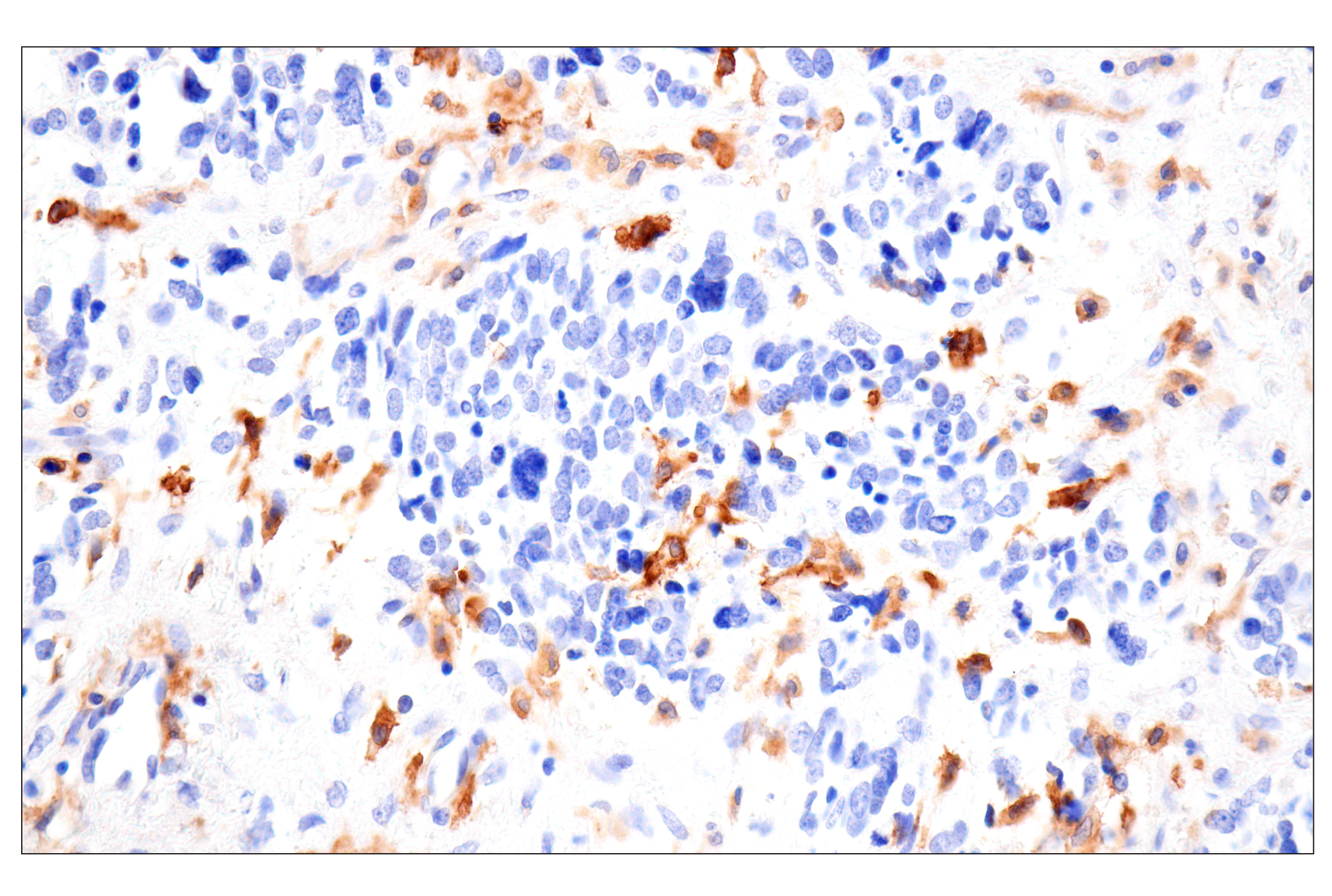 Immunohistochemistry Image 1: SLC40A1/Ferroportin-1 (F9U5S) Rabbit mAb