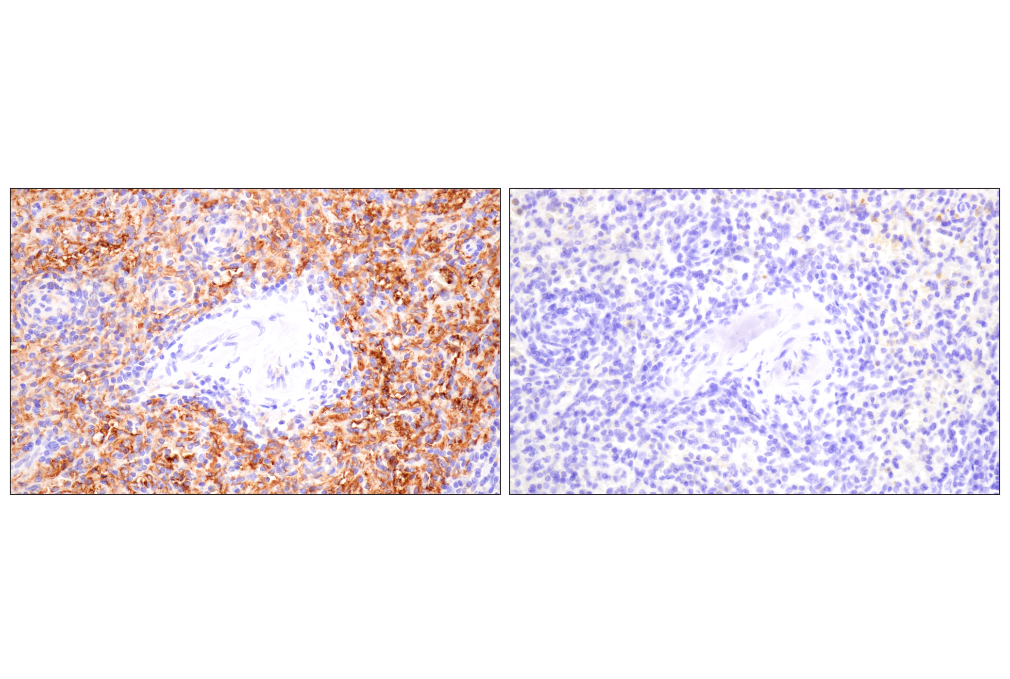 Immunohistochemistry Image 7: SLC40A1/Ferroportin-1 (F9U5S) Rabbit mAb