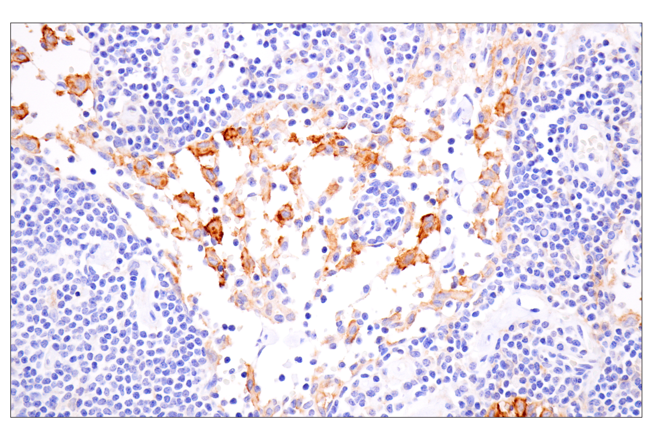 Immunohistochemistry Image 5: SLC40A1/Ferroportin-1 (F9U5S) Rabbit mAb