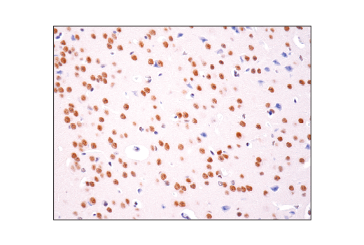 Immunohistochemistry Image 3: HAUSP (D17C6) XP® Rabbit mAb