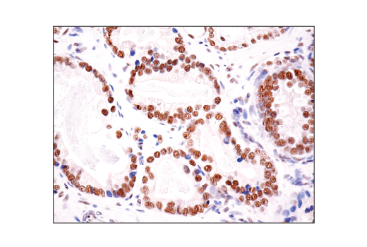 Immunohistochemistry Image 6: HAUSP (D17C6) XP® Rabbit mAb