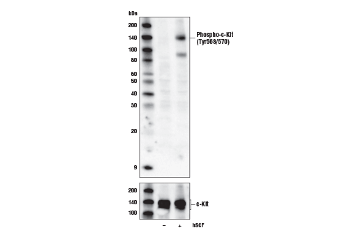 Western Blotting Image 1: Phospho-c-Kit (Tyr568/570) Antibody