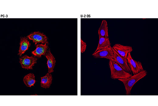 Immunofluorescence Image 1: DKK1 (D5V6L) Rabbit mAb