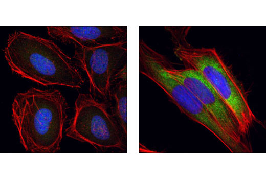 Immunofluorescence Image 1: Phospho-S6 Ribosomal Protein (Ser240/244) (61H9) Rabbit mAb