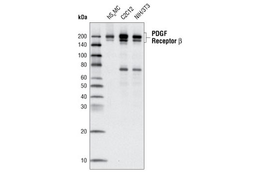 Western Blotting Image 1: PDGF Receptor β (C82A3) Rabbit mAb (BSA and Azide Free)