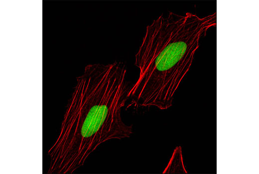 Immunofluorescence Image 1: RecQL1 (Q1N3) Mouse mAb