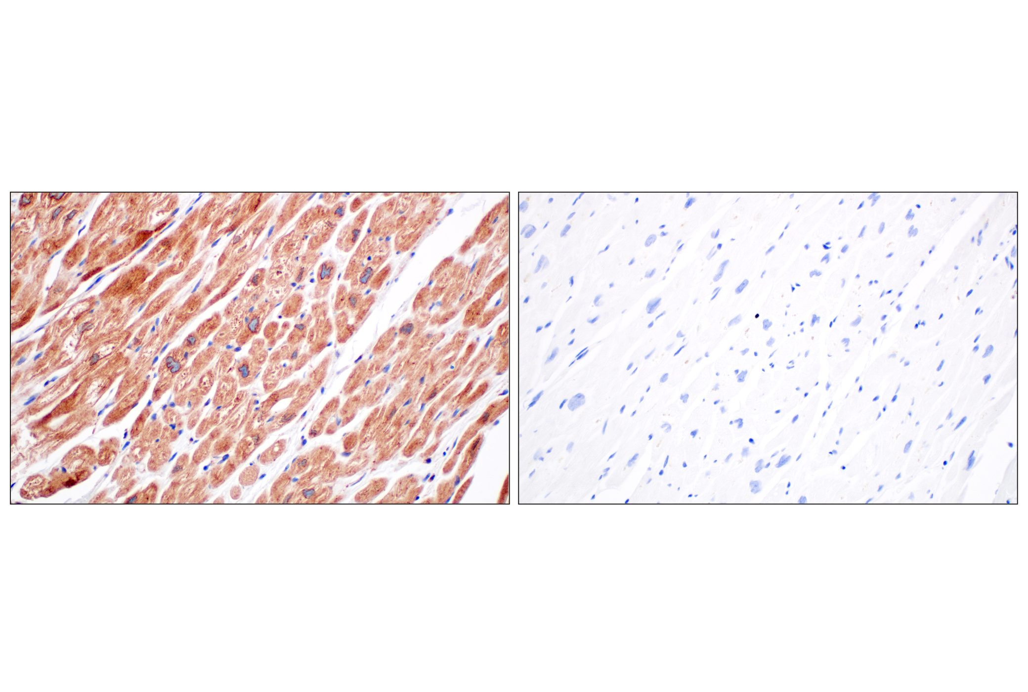 Immunohistochemistry Image 12: EEA1 (E9Q6G) Mouse mAb