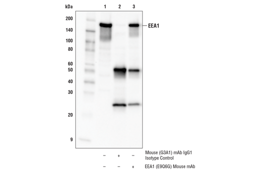 Immunoprecipitation Image 2: EEA1 (E9Q6G) Mouse mAb