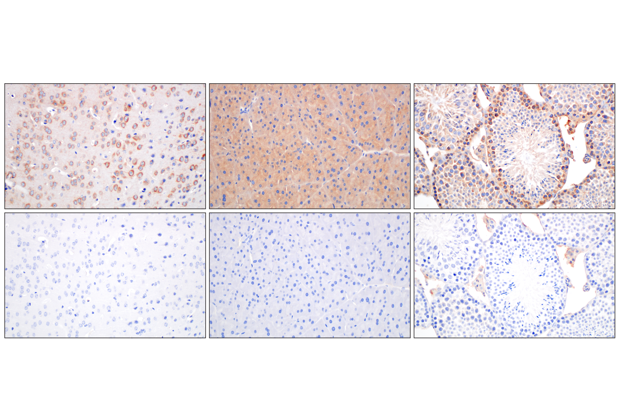 Immunohistochemistry Image 11: EEA1 (E9Q6G) Mouse mAb