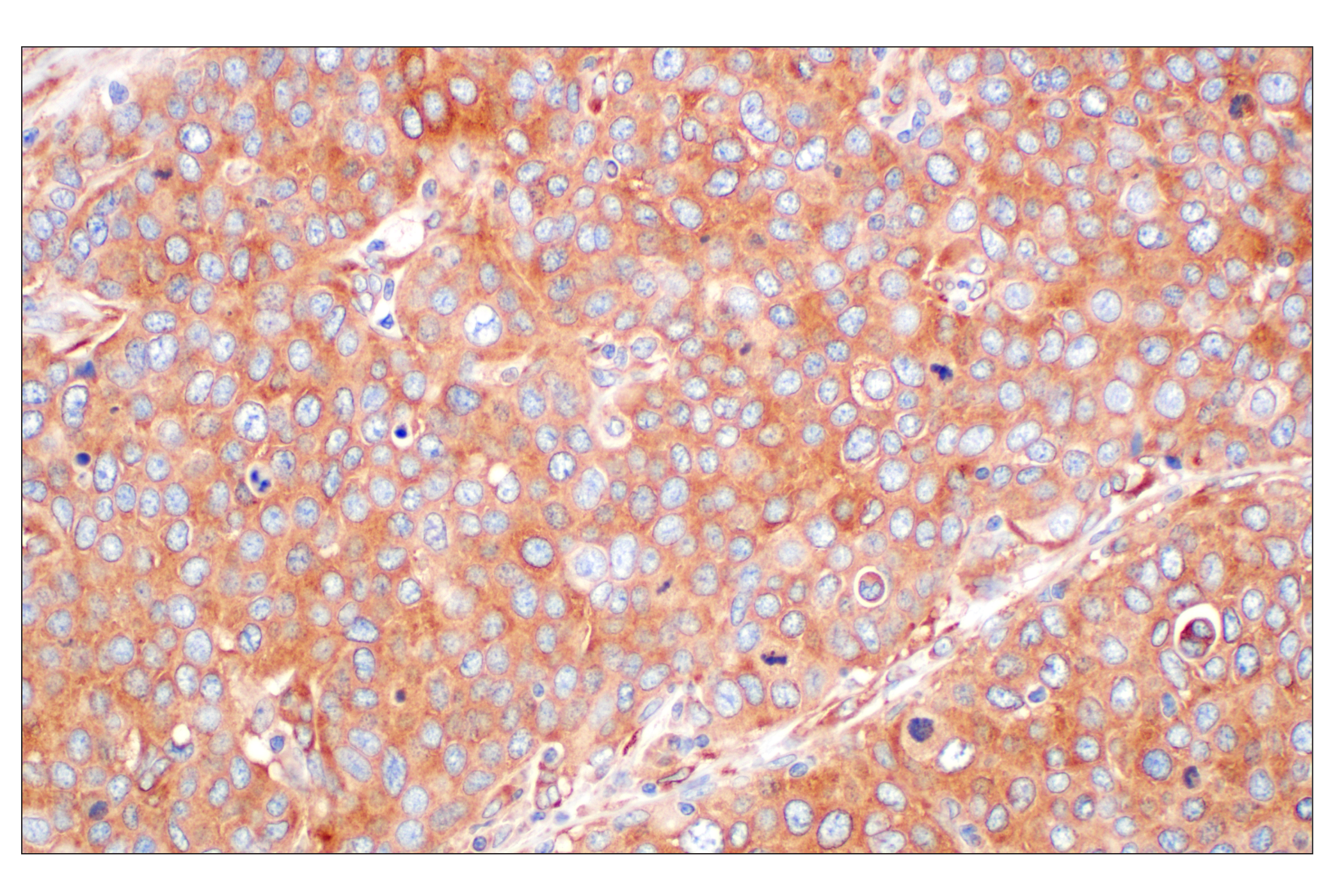 Immunohistochemistry Image 1: EEA1 (E9Q6G) Mouse mAb