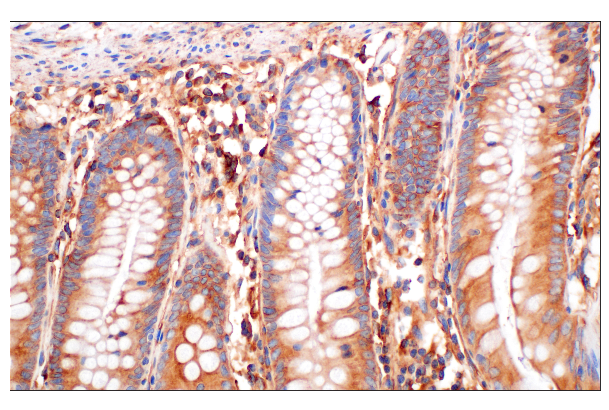 Immunohistochemistry Image 6: EEA1 (E9Q6G) Mouse mAb