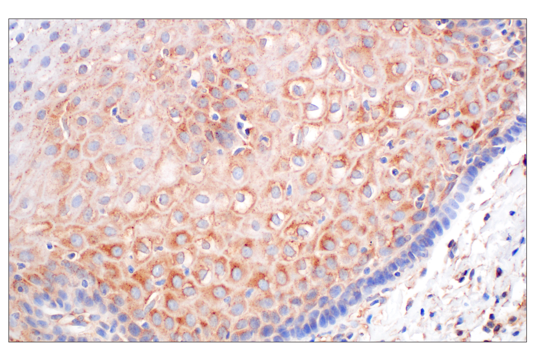 Immunohistochemistry Image 9: EEA1 (E9Q6G) Mouse mAb