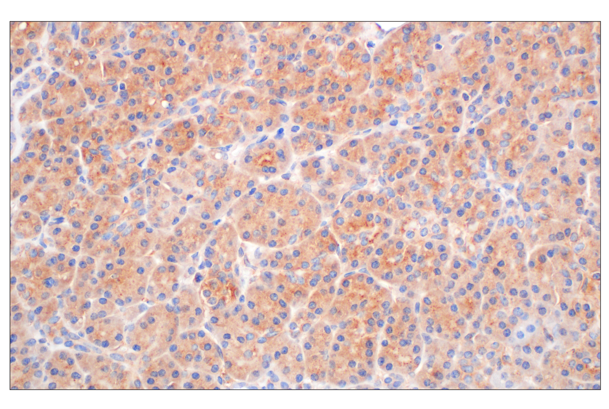 Immunohistochemistry Image 10: EEA1 (E9Q6G) Mouse mAb