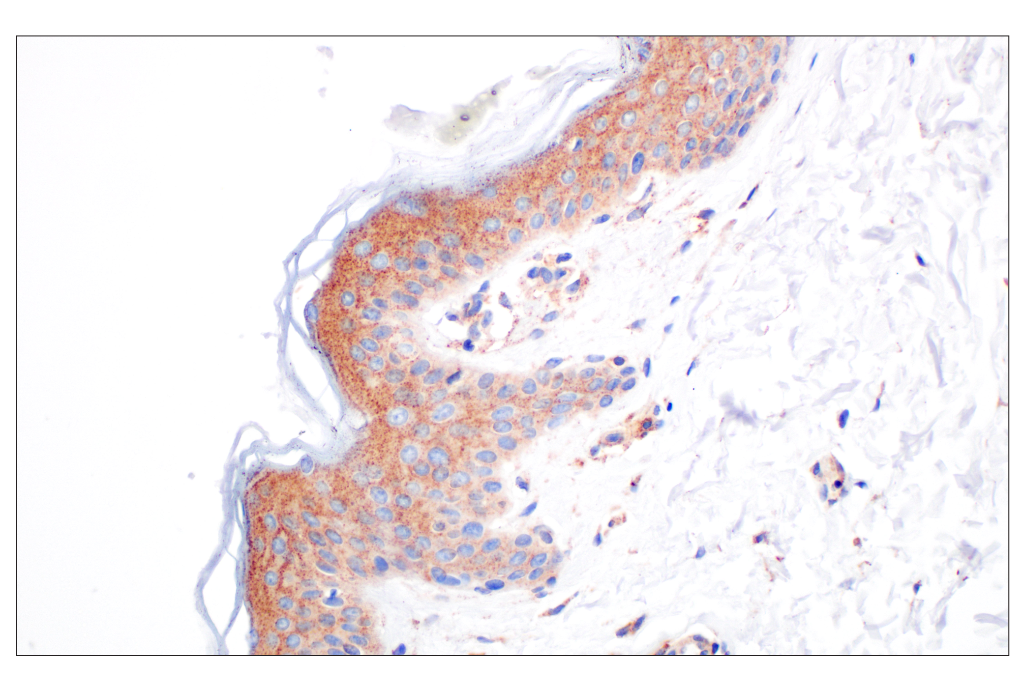 Immunohistochemistry Image 8: EEA1 (E9Q6G) Mouse mAb
