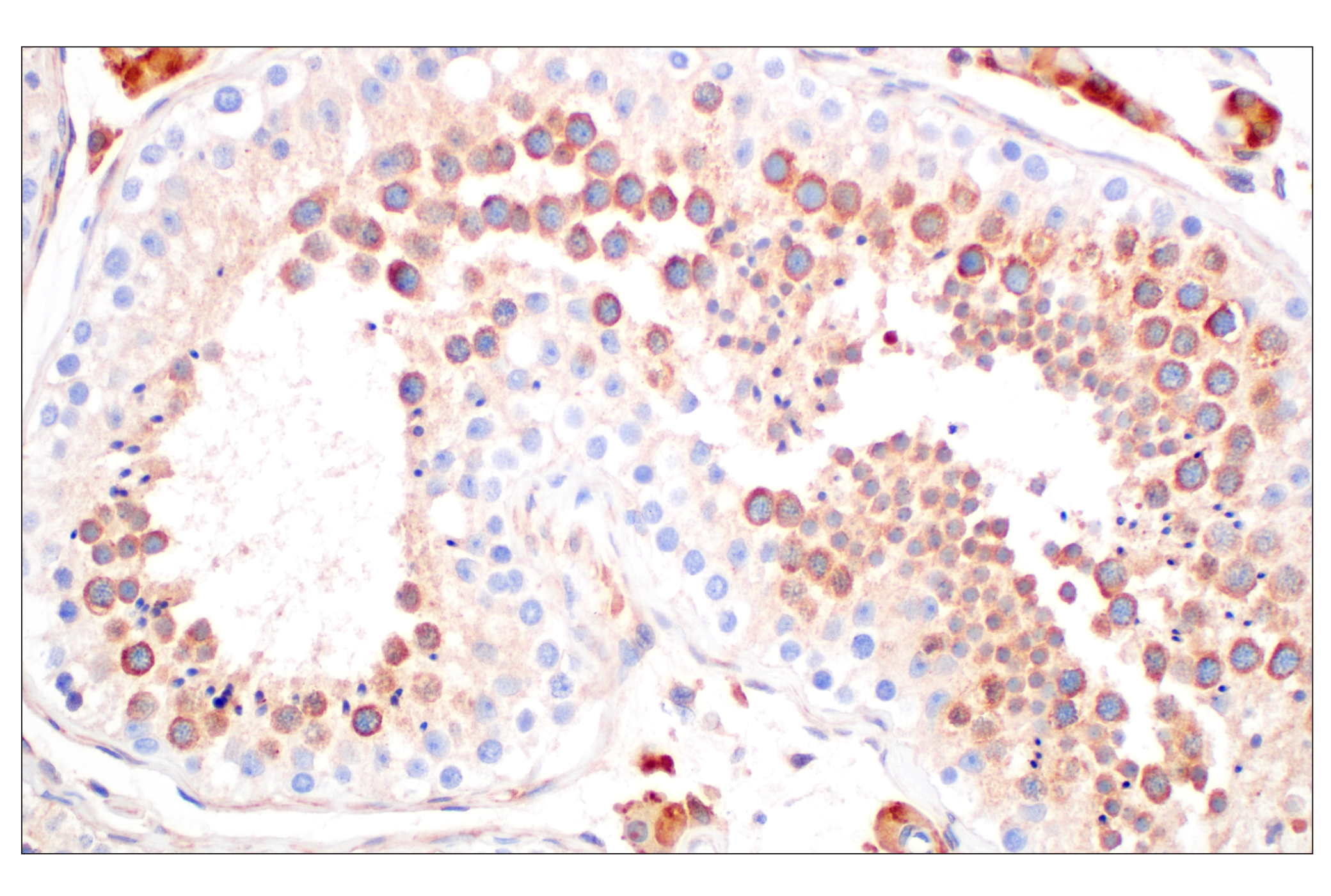 Immunohistochemistry Image 7: EEA1 (E9Q6G) Mouse mAb